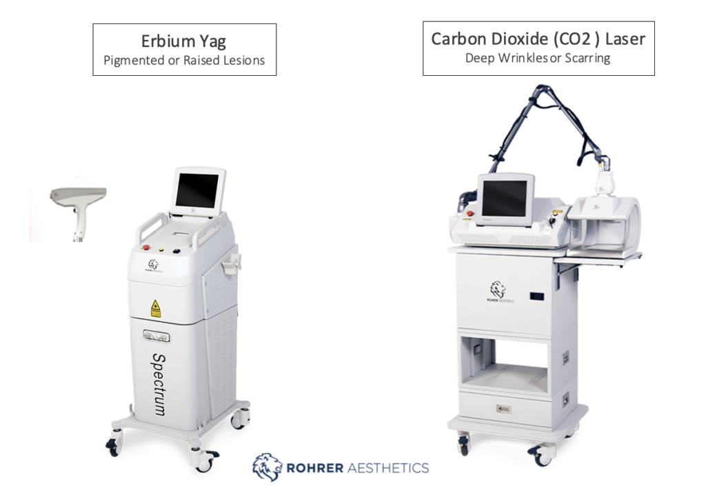 Ablative Lasers Richmond ENT