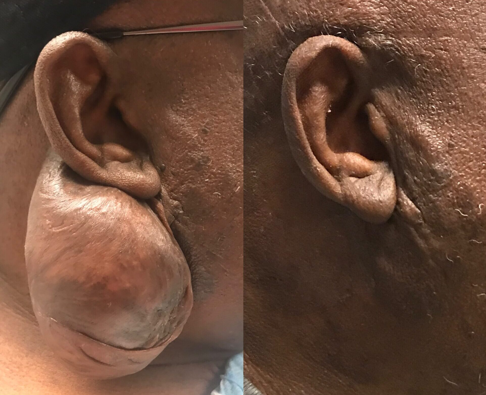 Cartilage Cuff Earrings Pierced Ears | Earrings Cartilage Ear Clips - Steel  Leaf Ear - Aliexpress